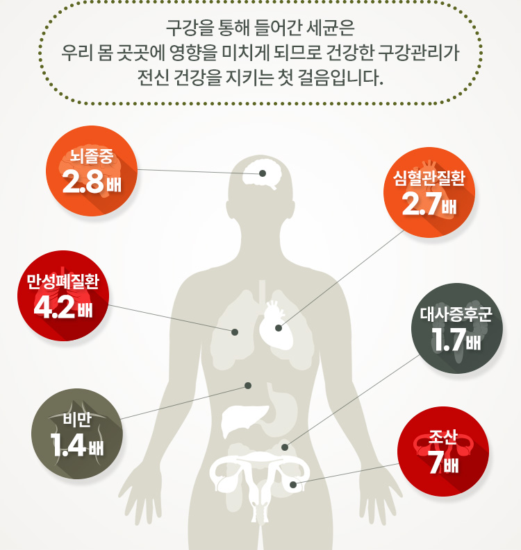 구강을 통해 들어간 세균은 우리 몸 곳곳에 영향을 미치게 되므로 건강한 구강관리가 전신 건강을 지키는 첫 걸음입니다.